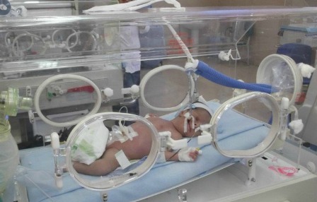  تجديد حبس طبيب للإهمال الطبي أدى لضمور خلايا المخ لرضيع بكفر الشيخ