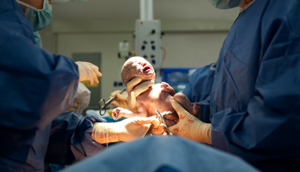  صور| طفل يولد بعين واحدة فى منتصف جبهته
